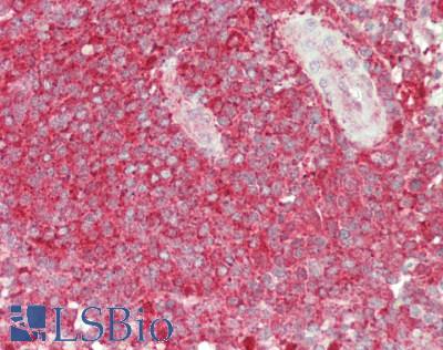 USP6NL Antibody - Human Spleen: Formalin-Fixed, Paraffin-Embedded (FFPE)