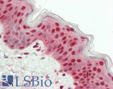 USP7 / HAUSP Antibody - Human Skin: Formalin-Fixed, Paraffin-Embedded (FFPE)