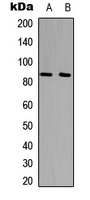UTP14A Antibody - Western blot analysis of UTP14A expression in HepG2 (A); HeLa (B) whole cell lysates.