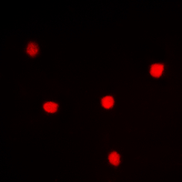 UTP14A Antibody - Immunofluorescent analysis of UTP14A staining in HeLa cells. Formalin-fixed cells were permeabilized with 0.1% Triton X-100 in TBS for 5-10 minutes and blocked with 3% BSA-PBS for 30 minutes at room temperature. Cells were probed with the primary antibody in 3% BSA-PBS and incubated overnight at 4 deg C in a humidified chamber. Cells were washed with PBST and incubated with a DyLight 594-conjugated secondary antibody (red) in PBS at room temperature in the dark. DAPI was used to stain the cell nuclei (blue).