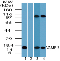 VAMP3 / VAMP-3 Antibody - Western blot of VAMP-3 in human brain lysate in the 1) absence and 2) presence of immunizing peptide 3) mouse brain and 4) rat brain using VAMP3 / VAMP-3 Antibody at 1.0 ug/ml.