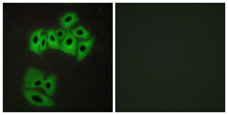 VAMP4 / VAMP-4 Antibody - Immunofluorescence analysis of A549 cells, using VAMP4 Antibody. The picture on the right is blocked with the synthesized peptide.