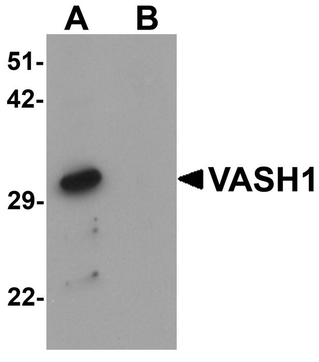 Vasohibin 1 / VASH1 Antibody - Western blot analysis of VASH1 in human brain tissue lysate with VASH1 antibody at 1 ug/ml in (A) the absence and (B) the presence of blocking peptide.