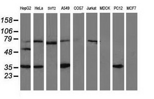 VASP Antibody - Western blot of extracts (35 ug) from 9 different cell lines by using anti-VASP monoclonal antibody.