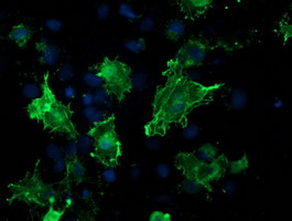 VASP Antibody - Anti-VASP mouse monoclonal antibody immunofluorescent staining of COS7 cells transiently transfected by pCMV6-ENTRY VASP.