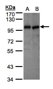 VAV1 / VAV Antibody - Sample (30 ug of whole cell lysate). A: MOLT4, B: Raji . 7.5% SDS PAGE. VAV1 / VAV antibody diluted at 1:500
