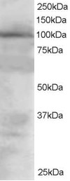 VAV2 Antibody - Staining (1.5 ug/ml) of 293 lysate (RIPA buffer, 30 ug total protein per lane). Primary incubated for 1 hour. Detected by chemiluminescence.