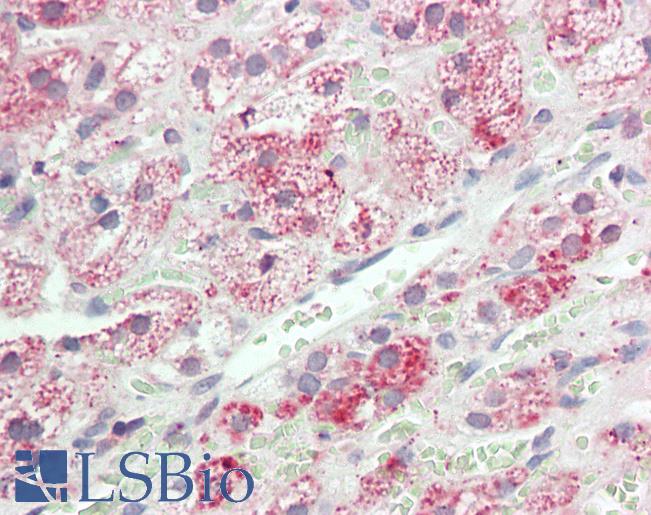 VCAM1 / CD106 Antibody - Anti-VCAM1 / CD106 antibody IHC staining of human adrenal. Immunohistochemistry of formalin-fixed, paraffin-embedded tissue after heat-induced antigen retrieval. Antibody concentration 5 ug/ml.