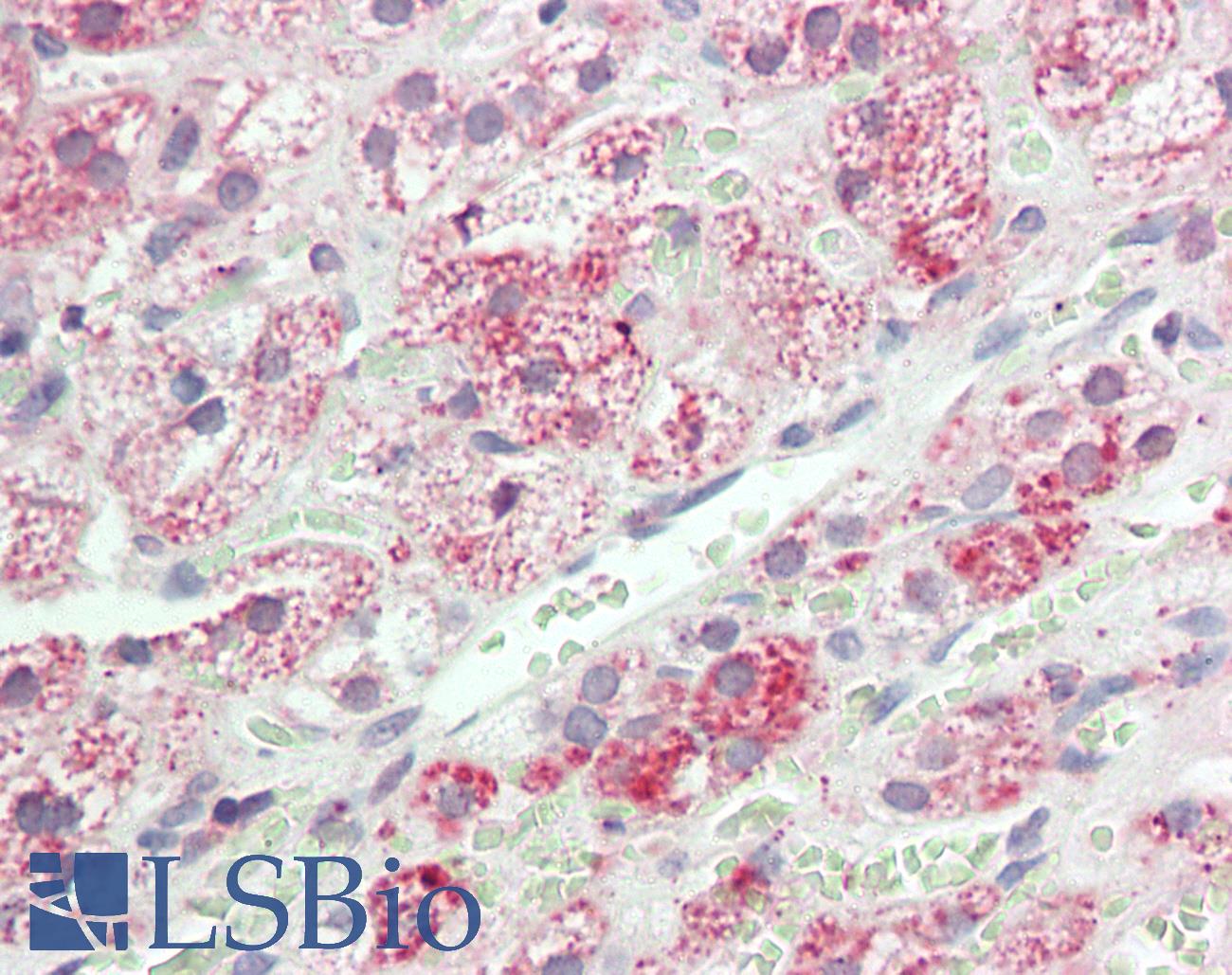 VCAM1 / CD106 Antibody - Anti-VCAM1 / CD106 antibody IHC staining of human adrenal. Immunohistochemistry of formalin-fixed, paraffin-embedded tissue after heat-induced antigen retrieval. Antibody concentration 5 ug/ml.