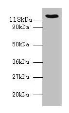 VCL / Vinculin Antibody - Western blot All lanes: Vinculin antibody at 2µg/ml + 293T whole cell lysate Secondary Goat polyclonal to rabbit IgG at 1/10000 dilution Predicted band size: 124, 117, 25 kDa Observed band size: 125 kDa