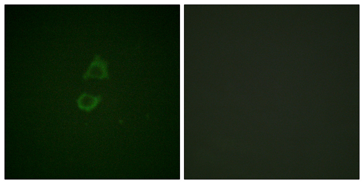 VCL / Vinculin Antibody - Immunofluorescence analysis of A549 cells, using Vinculin Antibody. The picture on the right is blocked with the synthesized peptide.