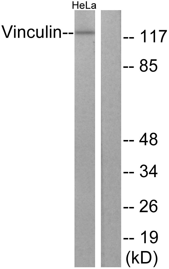 VCL / Vinculin Antibody - Western blot analysis of lysates from HeLa cells, treated with forskolin 40nM 30', using Vinculin Antibody. The lane on the right is blocked with the synthesized peptide.