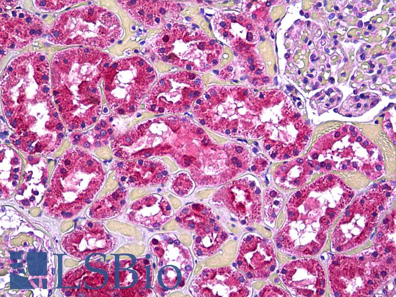 VCL / Vinculin Antibody - Anti-Vinculin antibody IHC of human kidney, tubules. Immunohistochemistry of formalin-fixed, paraffin-embedded tissue after heat-induced antigen retrieval. Antibody dilution 1:100.
