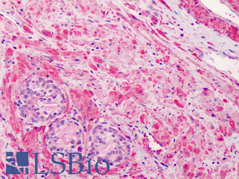 VCL / Vinculin Antibody - Anti-Vinculin antibody IHC of human prostate. Immunohistochemistry of formalin-fixed, paraffin-embedded tissue after heat-induced antigen retrieval. Antibody concentration 2.5 ug/ml. This image was taken for the unmodified form of this product. Other forms have not been tested.