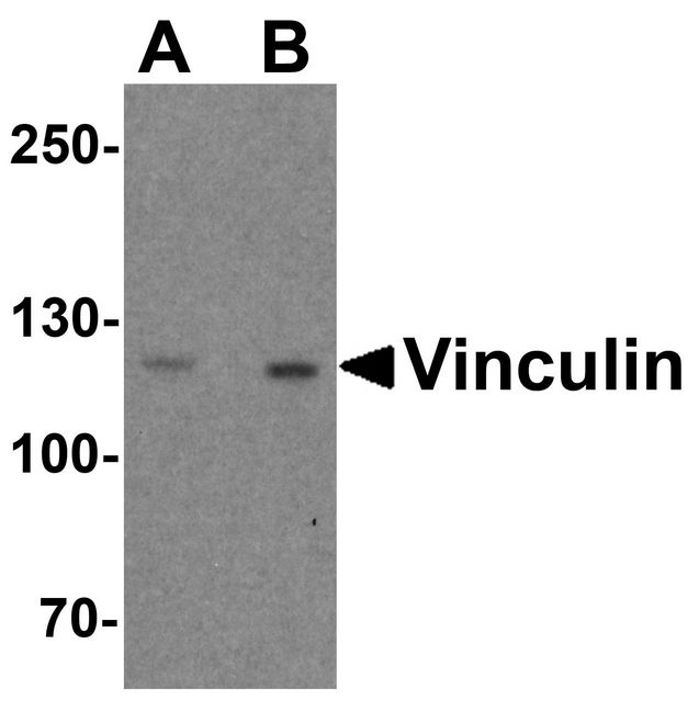 VCL / Vinculin Antibody - Western blot analysis of Vinculin in PC-3 cell lysate with Vinculin antibody at (A) 1 and (B) 2 ug/ml.