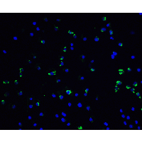 VCL / Vinculin Antibody - Immunofluorescence of Vinculin in Jurkat cells with Vinculin antibody at 20 µg/ml.