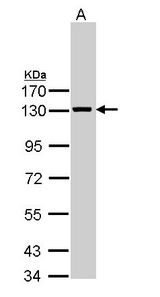 VCL / Vinculin Antibody - Sample (30 ug of whole cell lysate). A: A431. B: H1299. 7.5% SDS PAGE. VCL antibody diluted at 1:1000