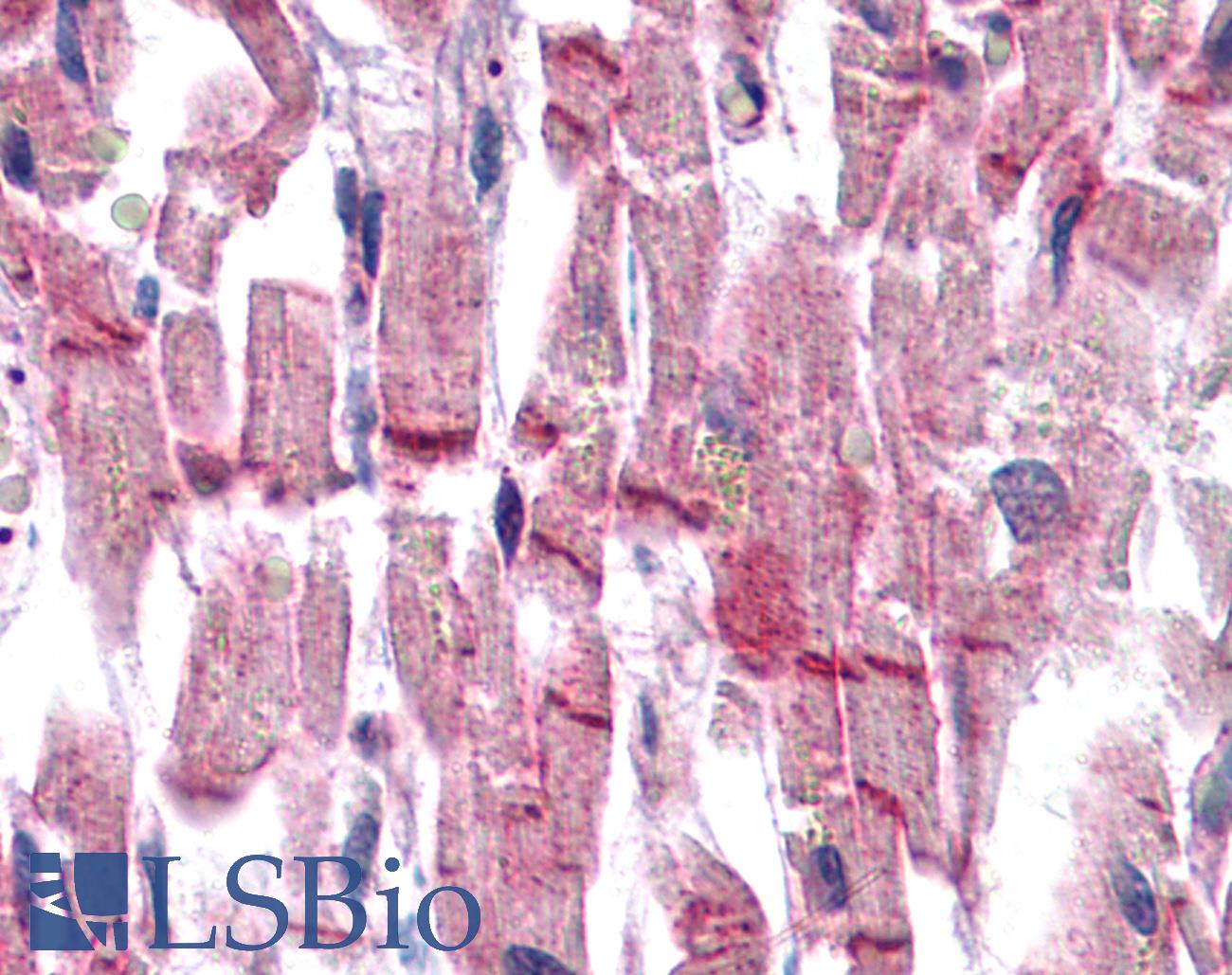 VCL / Vinculin Antibody - Anti-Vinculin antibody IHC of human heart. Immunohistochemistry of formalin-fixed, paraffin-embedded tissue after heat-induced antigen retrieval. Antibody concentration 10 ug/ml.