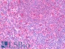 VCP Antibody - Anti-VCP antibody IHC staining of human tonsil. Immunohistochemistry of formalin-fixed, paraffin-embedded tissue after heat-induced antigen retrieval. Antibody concentration 5 ug/ml.