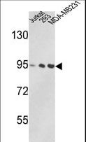 VCP Antibody - Western blot of VCP Antibody in Jurkat, 293, MDA-MB231 cell line lysates (35 ug/lane). VCP (arrow) was detected using the purified antibody.