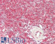 VCP Antibody - Human Spleen: Formalin-Fixed, Paraffin-Embedded (FFPE)
