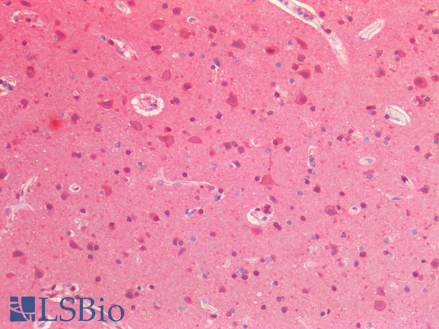 VCP Antibody - Human Brain, Cortex: Formalin-Fixed, Paraffin-Embedded (FFPE)