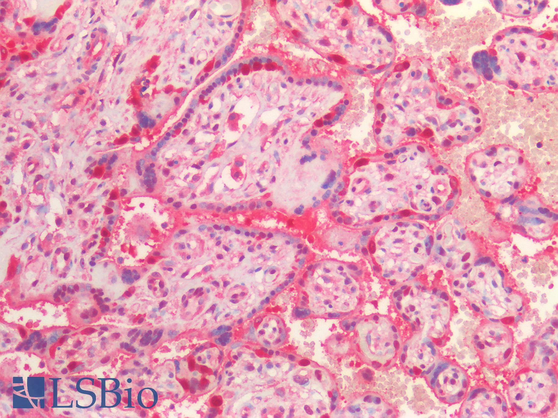 VCP Antibody - Human Placenta: Formalin-Fixed, Paraffin-Embedded (FFPE)
