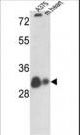 VDAC1 / PORIN Antibody - Western blot of VDAC1 Antibody in A375 cell line and mouse heart tissue lysates (35 ug/lane). VDAC1 (arrow) was detected using the purified antibody.
