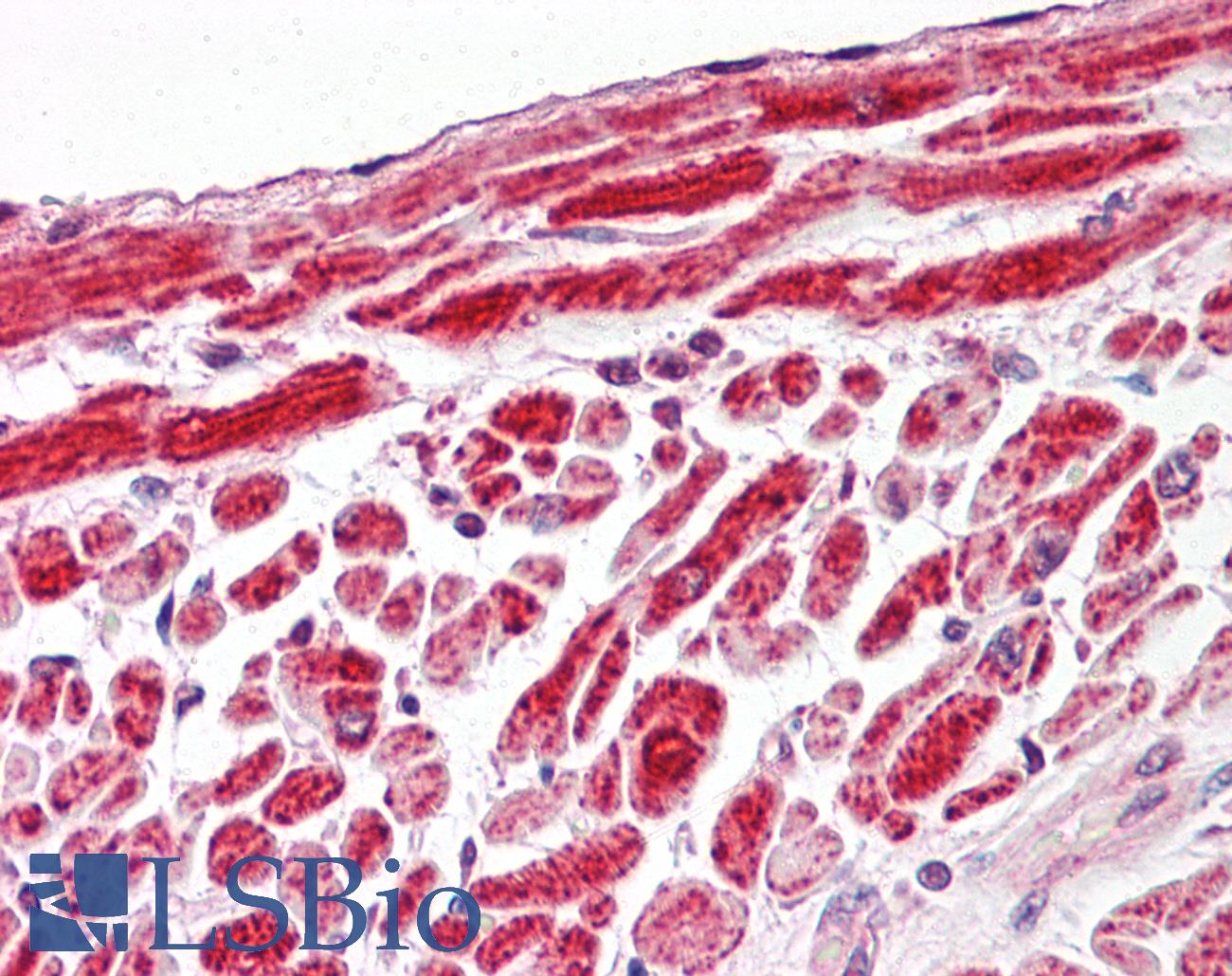 VDAC1 / PORIN Antibody - Anti-PORIN / VDAC-1 antibody IHC of human heart. Immunohistochemistry of formalin-fixed, paraffin-embedded tissue after heat-induced antigen retrieval. Antibody dilution 1:200.