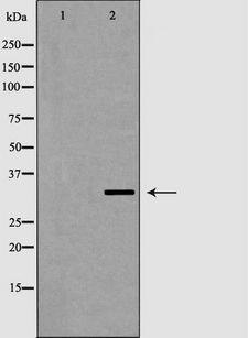 VDAC2 Antibody - Western blot analysis of VDAC2 expression in HeLa. The lane on the left is treated with the antigen-specific peptide.