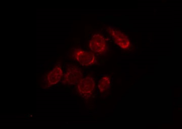 VDAC2 Antibody - Staining HeLa cells by IF/ICC. The samples were fixed with PFA and permeabilized in 0.1% Triton X-100, then blocked in 10% serum for 45 min at 25°C. The primary antibody was diluted at 1:200 and incubated with the sample for 1 hour at 37°C. An Alexa Fluor 594 conjugated goat anti-rabbit IgG (H+L) Ab, diluted at 1/600, was used as the secondary antibody.