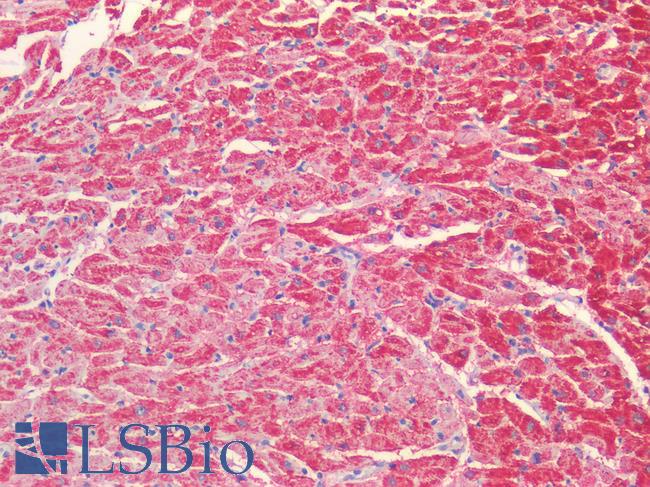 VDAC2 Antibody - Human Heart: Formalin-Fixed, Paraffin-Embedded (FFPE)