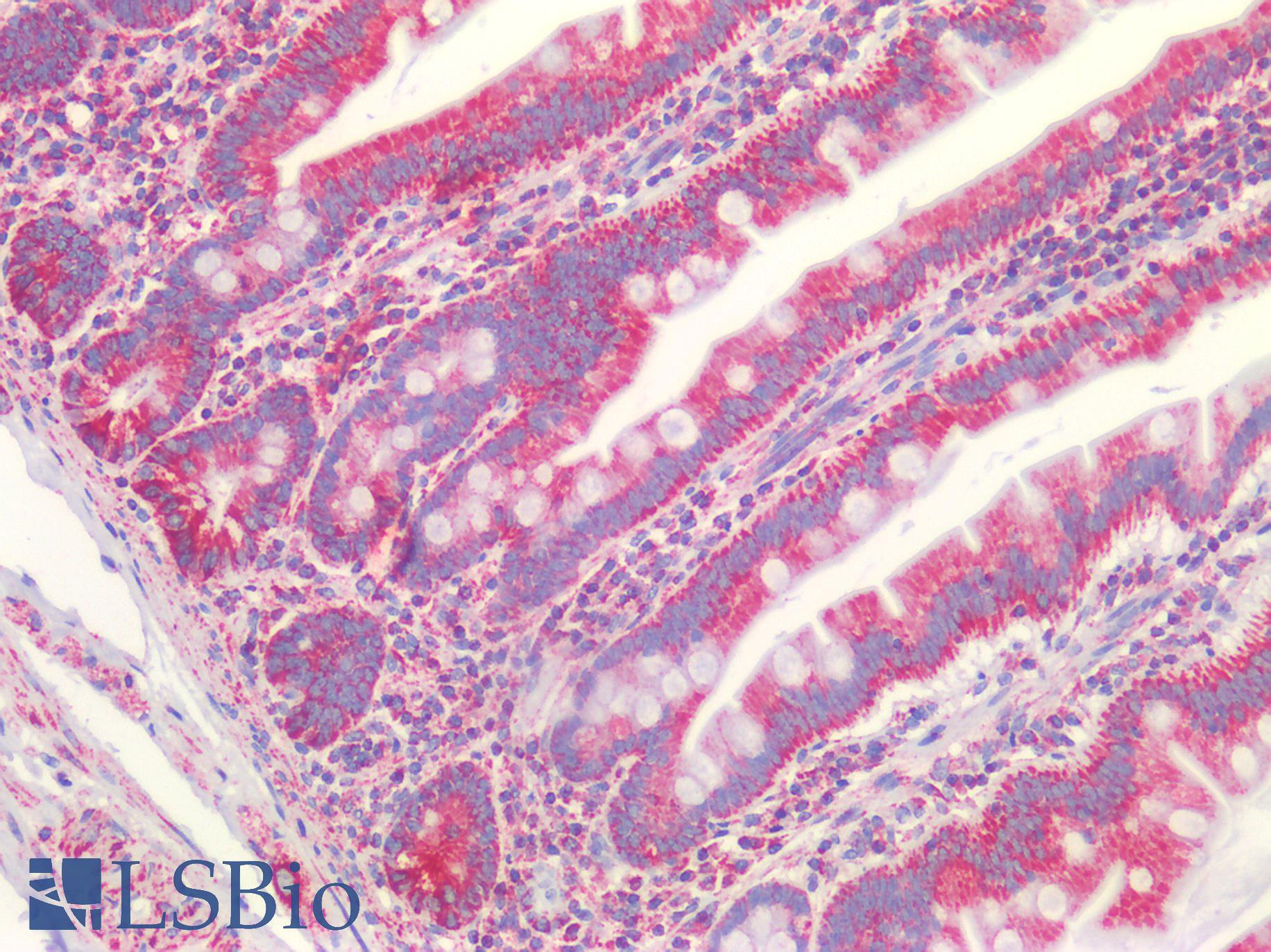 VDAC2 Antibody - Human Small Intestine: Formalin-Fixed, Paraffin-Embedded (FFPE)