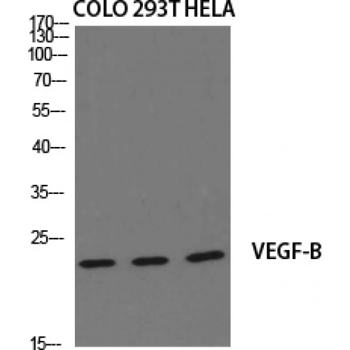 VEGFB Antibody - Western blot of VEGFB antibody