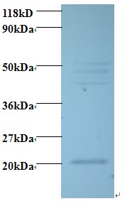 VEGFC Antibody - Western blot of Vascular endothelial growth factor C Antibody at 2 ug/ml + 293T whole cell lysate at 20 ug. Secondary: Goat polyclonal to Rabbit IgG at 1:15000 dilution. Predicted band size: 46 kDa. Observed band size: 46 kDa Additional bands at: 20 kDa. We are unsure as to the identity of these extra band.  This image was taken for the unconjugated form of this product. Other forms have not been tested.