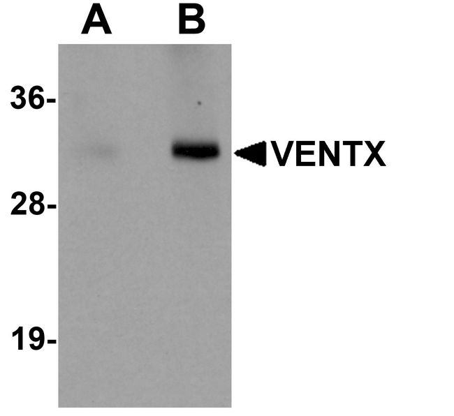 VENTX Antibody - Western blot analysis of VENTX in mouse brain tissue lysate with VENTX antibody at (A) 1 and (B) 2 ug/ml.