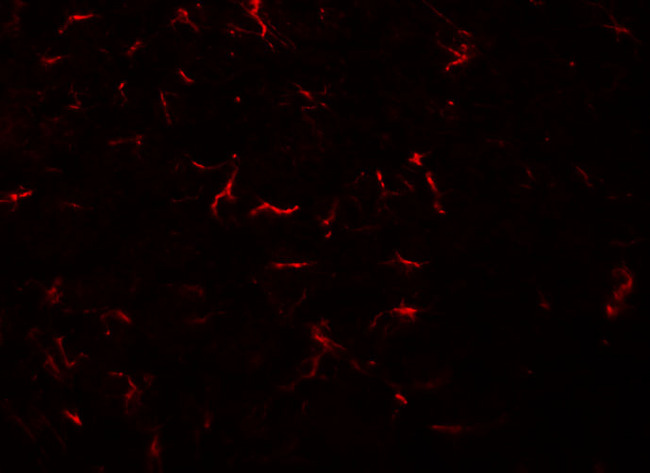VENTX Antibody - Immunofluorescence of VENTX in rat brain tissue with VENTX antibody at 20 ug/ml.