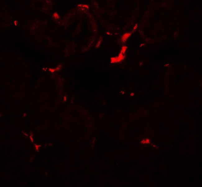 VEZT / Verzatin Antibody - Immunofluorescence of TRIP12 in rat colon tissue with TRIP12 antibody at 20 ug/ml.