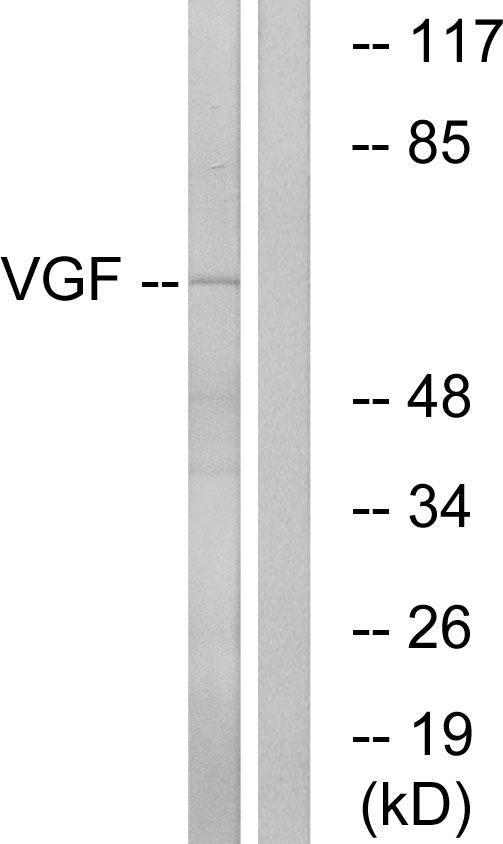 VGF Antibody - Western blot analysis of lysates from RAW264.7 cells, using VGF Antibody. The lane on the right is blocked with the synthesized peptide.