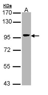 VIL1 / Villin Antibody - Sample (30 ug of whole cell lysate). A: Hep G2 . 7.5% SDS PAGE. Villin antibody diluted at 1:5000