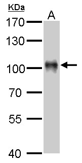 VIL1 / Villin Antibody - Villin antibody detects VIL1 protein by Western blot analysis. A. 50 ug mouse kidney lysate/extract. 7.5 % SDS-PAGE. Villin antibody dilution:1:1000