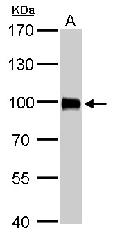 VIL1 / Villin Antibody - Villin antibody detects VIL1 protein by Western blot analysis. A. 50 ug rat kidney lysate/extract. 7.5 % SDS-PAGE. Villin antibody dilution:1:2000