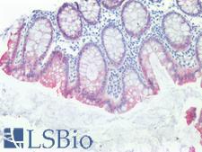 VIL1 / Villin Antibody - Human Colon: Formalin-Fixed, Paraffin-Embedded (FFPE)