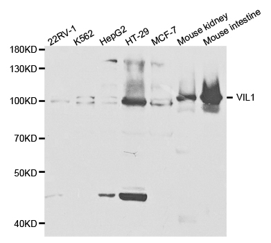 VIL1 / Villin Antibody - Western blot analysis of extracts of various cell lines, using VIL1 antibody.