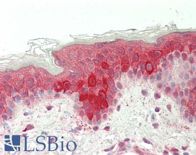 VIL1 / Villin Antibody - Human Skin: Formalin-Fixed, Paraffin-Embedded (FFPE)