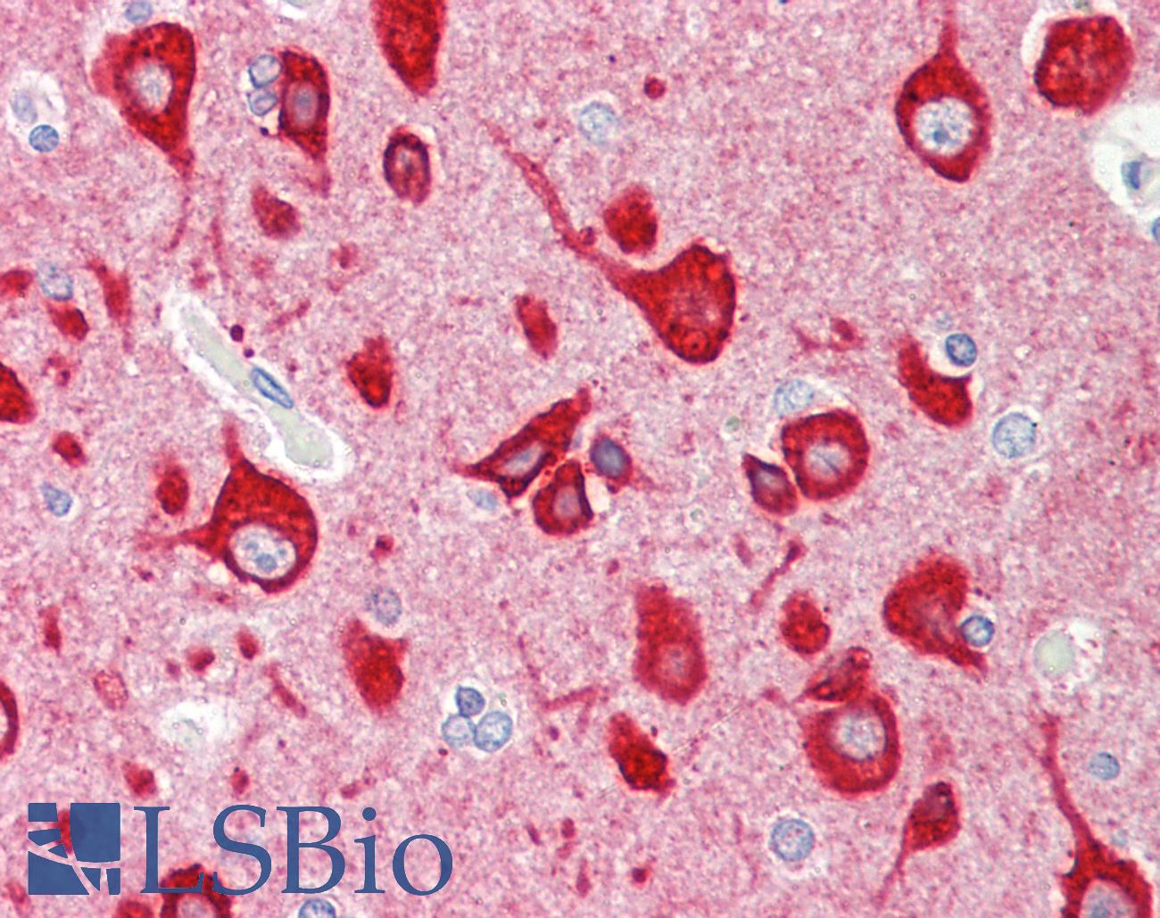 VILIP / VSNL1 Antibody - Anti-VILIP / VSNL1 antibody IHC staining of human brain, cortex. Immunohistochemistry of formalin-fixed, paraffin-embedded tissue after heat-induced antigen retrieval.