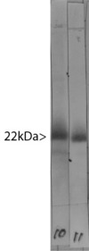 VILIP / VSNL1 Antibody - Western blot of bovine cerebellum homogenate stained with VILIP / VSNL1 antibody in lane 10. Note the strong clean band running at 22kDa. Lane 11 shows the same material stained with an alternate antibody to VSNL1, which binds to the same band.
