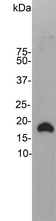 VILIP / VSNL1 Antibody - Western blot of rat brain homogenate stained with VSNL1. Note the strong clean band running at 18 kDa.
