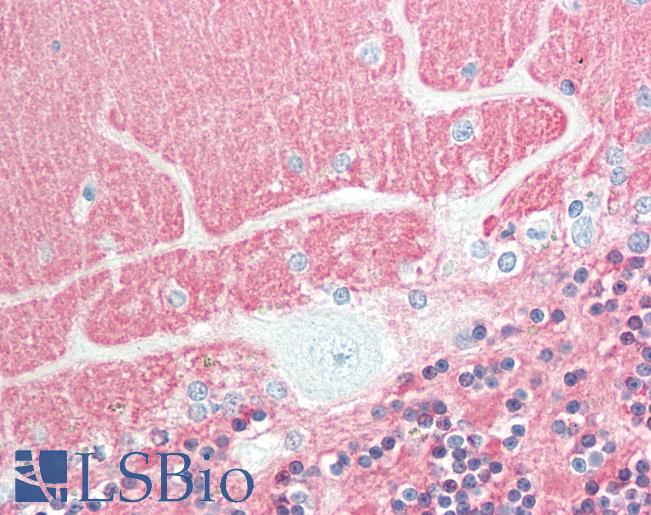 VILIP / VSNL1 Antibody - Anti-VILIP / VSNL1 antibody IHC staining of human brain, cerebellum. Immunohistochemistry of formalin-fixed, paraffin-embedded tissue after heat-induced antigen retrieval. Antibody dilution 1:500.