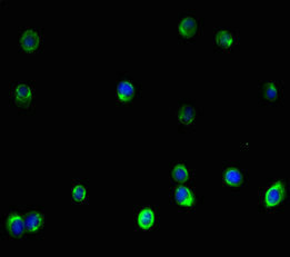 Vimentin Antibody - Immunofluorescent analysis of HepG2 cells using VIM Antibody at dilution of 1:100 and Alexa Fluor 488-congugated AffiniPure Goat Anti-Rabbit IgG(H+L)